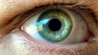 Über Augenlaserchirurgie