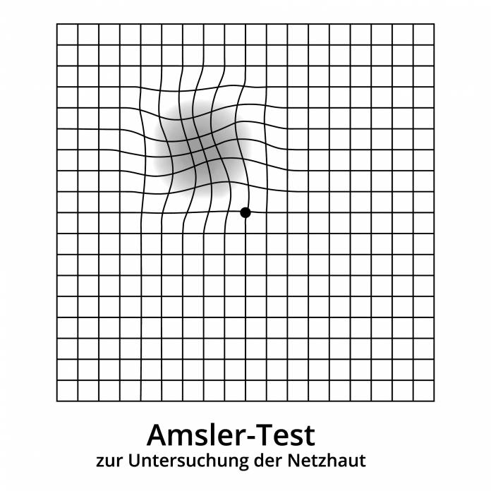 Amsler-Test